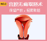 澳洲MIDEN内窥镜无痛取胚术 无痛人流国际金标准